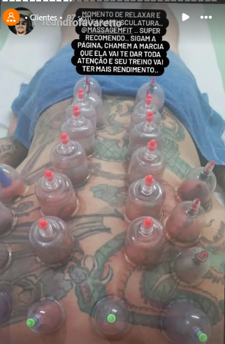 Drenagem linfática sendo realizada por massoterapeuta em Osasco
