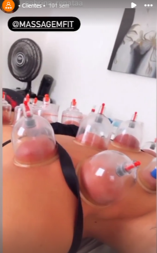 Massagem modeladora em Osasco para redução de medidas